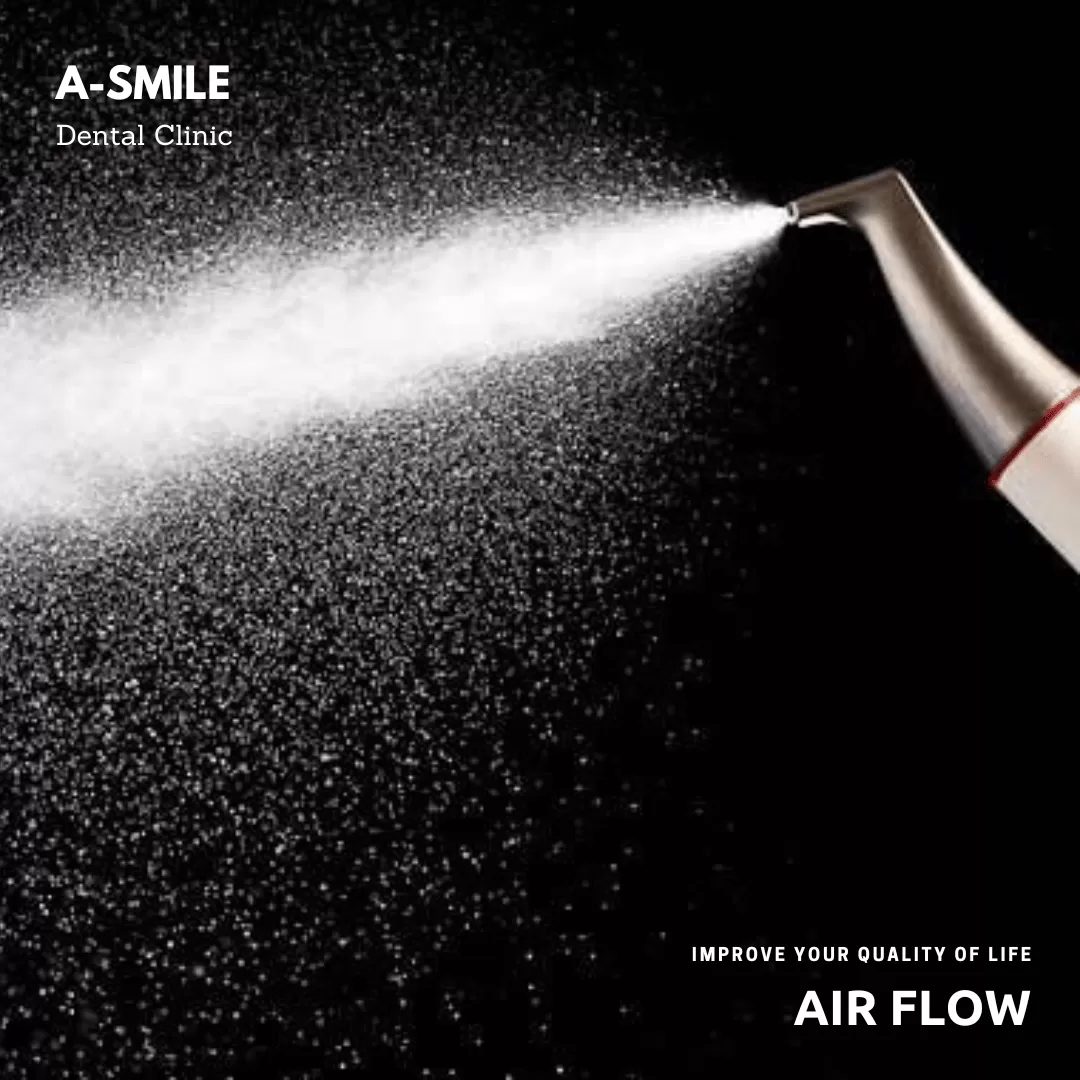 ลบคราบสีฝังแน่น ด้วย Air Flow