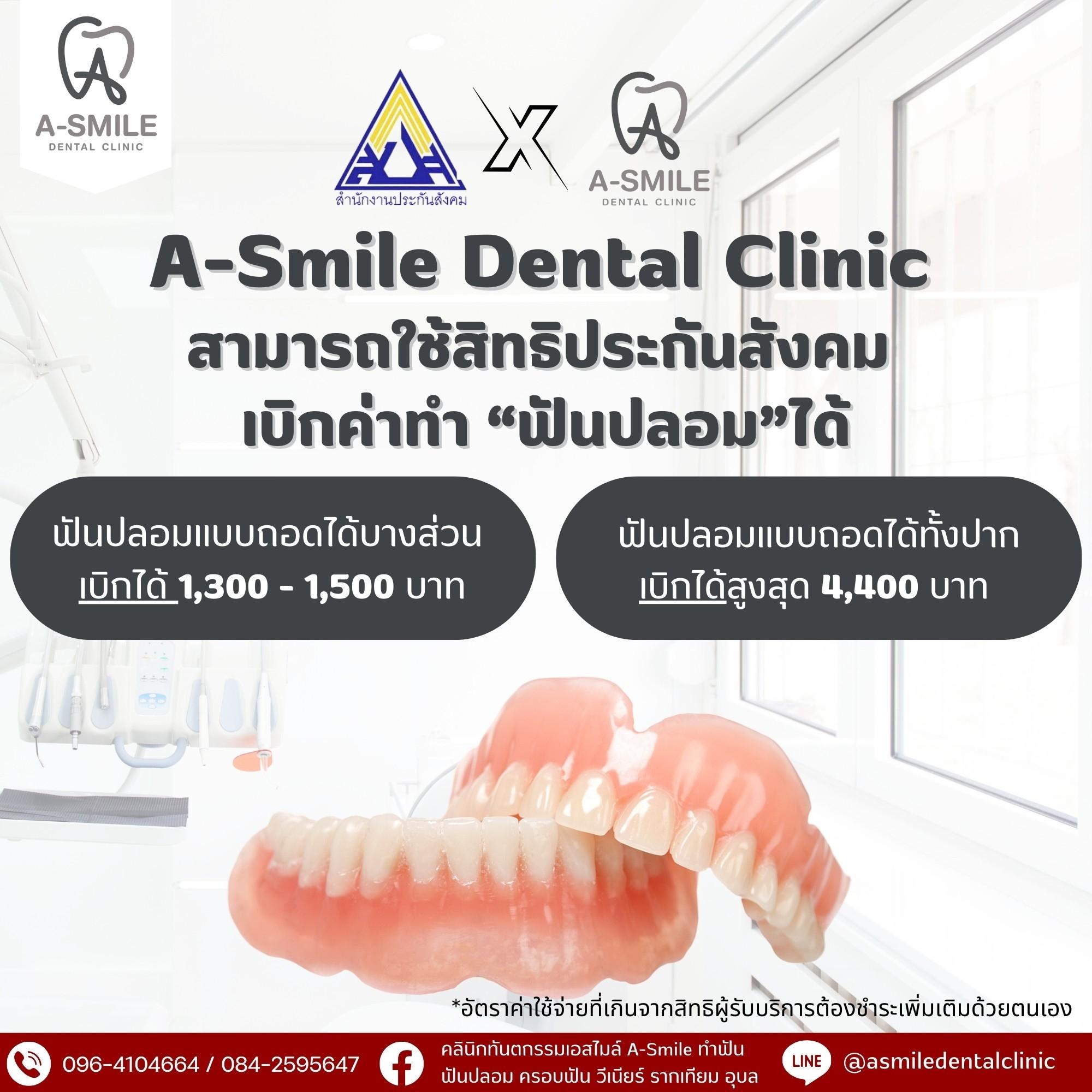 คลินิกทําฟัน อุบล ประกันสังคม ไม่ต้องสํารองจ่าย